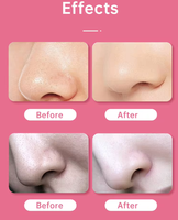 Mini aspirateur visuel électrique pour points noirs, nettoyeur de pores du visage, appareil de beauté pour un nettoyage en profondeur à domicile