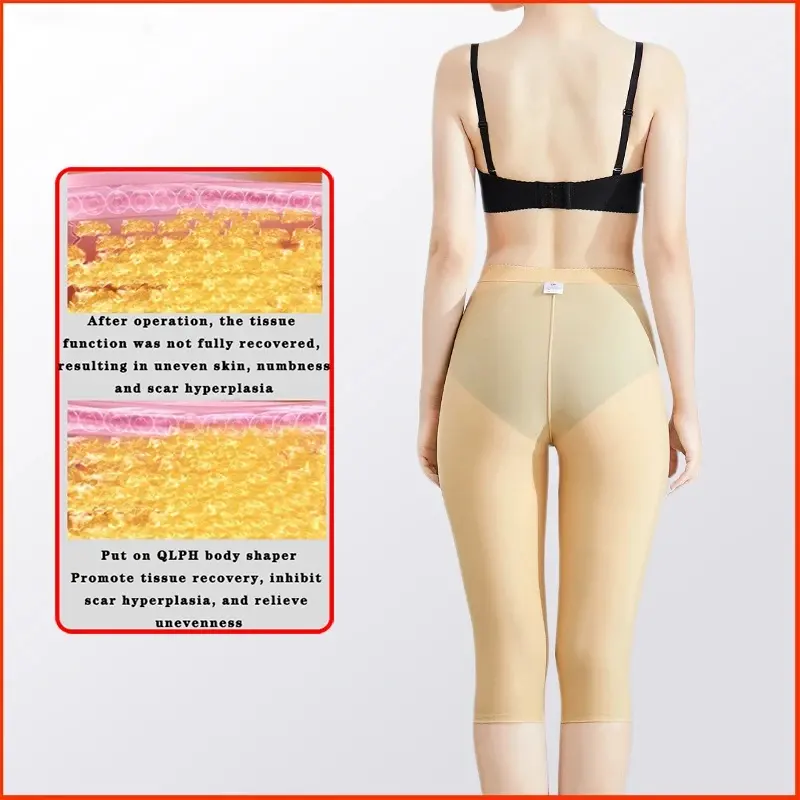 Women Thigh Shaper After Liposuction Surgery Fat Filling Body Shaper Medical Grade Garment Compression Shapewear Belly Control