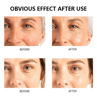 Crème pour le visage à 5% d'urée à usage quotidien de marque privée, l'hydratant pour peaux sèches aide à renforcer la barrière naturelle de la peau
