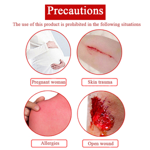 Parche Analgésico de 8 Piezas/Bolsa, Ungüento de Musk Tiger Bone, Pasta para Hernia Discal Lumbar y Yeso para Lesiones Musculares - Product Image 3