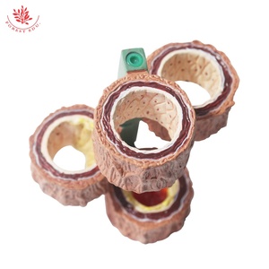 Modelos anatómicos Endurecimiento humano de la arteriosclerosis Modelo de 4 piezas para demostración de enfermedades vasculares Herramienta de enseñanza médica - Product Image 3