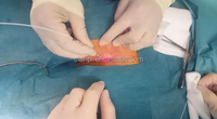 Laser Diode 980nm 1470nm pour le traitement des hémorroïdes, la proctologie, l'urologie, la fistule anale, les varices, les varicosités, appareil laser médical