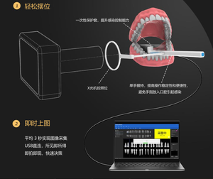 Le cliniche dentali vendono sensori Xpect di grandi dimensioni/tecnologia di Imaging/AI di un secondo. - Product Image 4