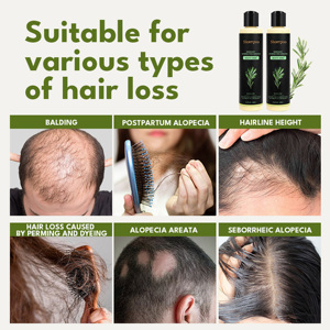 Champú Herbal de Romero Natural OEM Personalizado, Fórmula Antiencrespamiento, Control de Grasa, Crecimiento del Cabello, Nutrición del Cuero Cabelludo Seco - Product Image 4