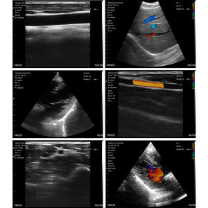 Dispositivo professionale ad ultrasuoni portatile con elementi 128 e impronte L45 per uso veterinario e <span class=keywords><strong>Imaging</strong></span> medico - Product Image 3