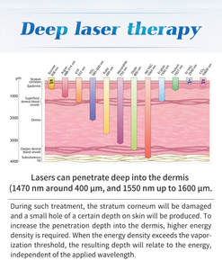 جديد الوصول جهاز الجمال لشد البشرة و إزالة التجاعيد ليزر دايود 1470nm للوجه - Product Image 6