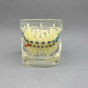 โมเดลการสาธิตการจัดฟันพร้อมสายรัดและแถบยางสำหรับคลินิกทันตกรรมและการสื่อสารกับผู้ป่วย - Product Image 3