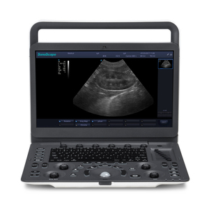 Escáner de Ultrasonido Veterinario <span class=keywords><strong>Sonoscape</strong></span> E1v <span class=keywords><strong>Vet</strong></span> 3D 2D Blanco y Negro Portátil Veterinario Ultrasonido BW - Product Image 4