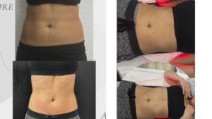 Đầy đủ cơ thể đường viền lipolaser 650nm liệu pháp ánh sáng đỏ EMS giảm béo chân không tần số vô tuyến xây dựng cơ bắp chất béo hòa tan máy - Product Image 6