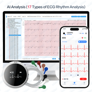 Viatom Lepod Pro Ekg Máquina 12 Chumbo <span class=keywords><strong>Ecg</strong></span> AI-<span class=keywords><strong>ECG</strong></span> Análise Portabilidade <span class=keywords><strong>Holter</strong></span> Monitor <span class=keywords><strong>Ecg</strong></span> Eletrodos de Eliminação Monitor de Cardio - Product Image 5