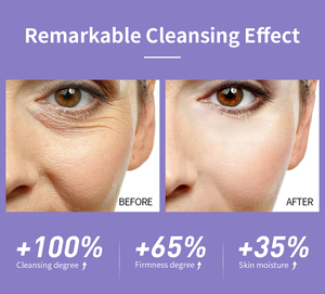Crema Facial Blanqueadora LANBENA Probiotic Keratin Shine Luxury Booster para Eliminar Manchas Oscuras, Crema Facial Gluta White - Product Image 6