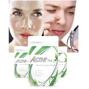 Wholesale Skin Care Beauty Products Skin Repair And Acne Remove Organic acne tea pimple tea