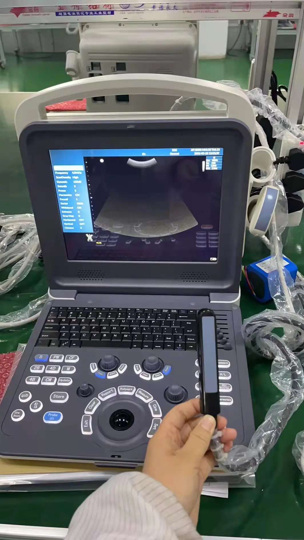 Portable Color Doppler Ultrasound Machine Laptop Ultrasound Scan Machine for Human