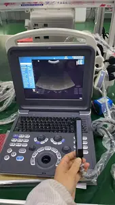 Portable Color Doppler Ultrasound Machine Laptop Ultrasound Scan Machine For Human