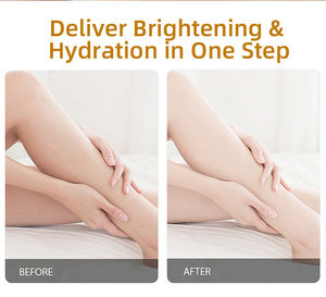 Lotion corporelle hydratante éclaircissante à base de <span class=keywords><strong>d</strong></span>érivé de vitamine C pour tous types de peaux - Product Image 6