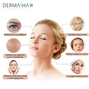 Equipo de Belleza de Alta Frecuencia Varita Portátil para Eliminación de Cicatrices de Acné Cuidado Facial y Reducción de Arrugas Máquina de Electroterapia - Product Image 5