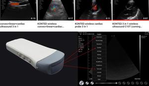 Konted MDR Gen5 lòng bàn tay siêu âm xách tay không dây máy siêu âm 3 trong <span class=keywords><strong>1</strong></span> đa chức năng duy nhất <span class=keywords><strong>probe</strong></span> cho toàn bộ cơ thể - Product Image 6