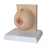 Modelo de Anatomía, Modelo de Seno, Modelo de Seno Patológico de Mujer Lactante, Comunicación Médica, Ayuda Médica