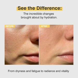 Diepe Collageen Stimulerende Crème In <span class=keywords><strong>Serum</strong></span> 30Ml Niacinamide Gezichtsserum Voor Vrouwen Hydrateren Voor Gevoelige Huid Multifunctionele Essentie - Product Image 4