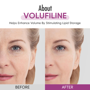 Sérum repulpant anti-âge pour le visage avec Volufiline, effet liftant, qui comble visiblement les zones creuses sans <span class=keywords><strong>injections</strong></span>, pour un volume quotidien accru. - Product Image 6