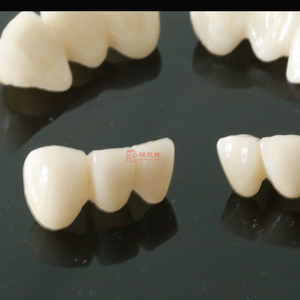 Couronne <span class=keywords><strong>monolithique</strong></span> de <span class=keywords><strong>zircone</strong></span> dentaire en céramique complète alliant force et beauté personnalisée par China Dental Lab - Product Image 6