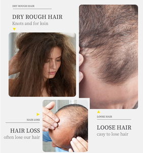 Vente chaude sérum de croissance rapide des cheveux concentré shampooing efficace de sauvetage contre la perte de cheveux - Product Image 3