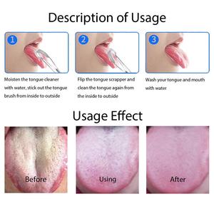 Rascador <span class=keywords><strong>de</strong></span> <span class=keywords><strong>lengua</strong></span> <span class=keywords><strong>de</strong></span> acero inoxidable para niños, rascador <span class=keywords><strong>de</strong></span> <span class=keywords><strong>lengua</strong></span> en forma <span class=keywords><strong>de</strong></span> U para el Cuidado oral personal, venta al por mayor - Product Image 4