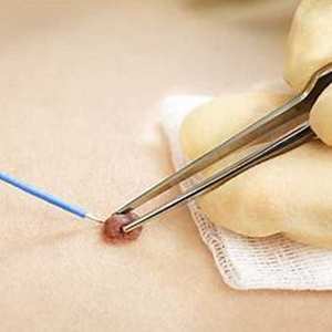 Générateurs électrochirurgicaux et appareils de cautérisation électriques ES-200PK 1100VA pour la chirurgie générale offrant une efficacité accrue - Product Image 5