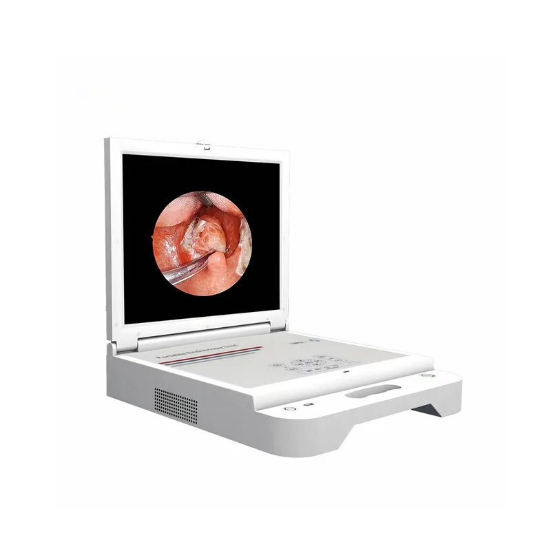 Medische Grade Portable Endoscopie Unit 17 Inch Hd Monitor 4 In 1 Led Lichtbron Endoscoop Camera