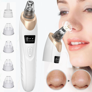 Removedor de Puntos Negros Eléctrico Recargable por USB, Limpiador de Poros al Vacío, Herramienta de Tratamiento Facial para el Acné de la Nariz - Product Image 2