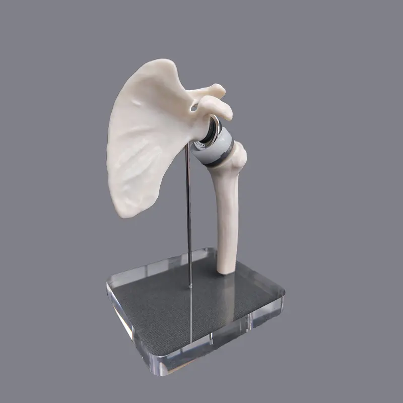 KyrenMed Mini Size Shoulder Joint Replacement Model Total Shoulder Arthroplasty Model For Orthopaedic Training Model