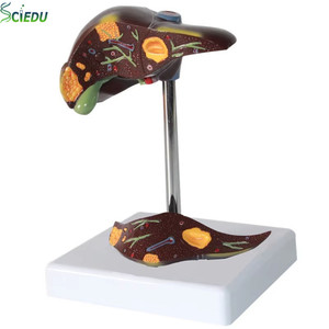 Model Lesi Hati Manusia Struktur Portal Hati Lobus Hati Peralatan Pengajaran Ilmu Kedokteran Model Anatomi - Product Image 1