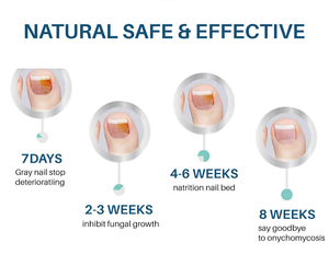 Nuevo Sérum Reparador para Uñas, Tratamiento para <span class=keywords><strong>Hongos</strong></span>, Cuidado de Uñas Dañadas, Crema Natural para Uñas de Pies y Manos <span class=keywords><strong>en</strong></span> <span class=keywords><strong>Piel</strong></span> Sensible - Product Image 6