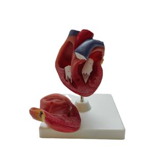 Modelo de Corazón Humano de PVC Duradero de Alta Calidad, 12*12*20cm, para Enseñanza Escolar y Médica, Aprendizaje de Anatomía, Marca Xuequan - Product Image 1