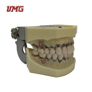 Modelo de Enfermedad Periodontal con Encía Transparente que Demuestra la Recesión Gingival para la Educación del Paciente en Clínicas Dentales - Product Image 3