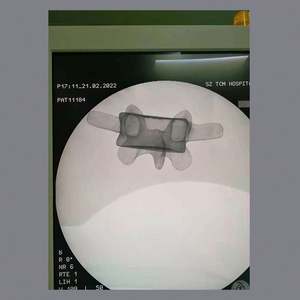 KyrenMed espuma sólida humana lombar 1 para sacro modelo espinhal lombar com raízes nervosas para ortopédica prática perfuração corte - Product Image 6