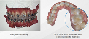CAD cam <span class=keywords><strong>New</strong></span> Arrival nhanh kỹ thuật số dentisit phòng khám phòng thí nghiệm ghế-Side nha khoa intraoral Scanner - Product Image 4