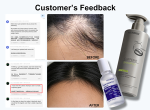 Champú y Acondicionador para Cabello Fino y Quebradizo, Fórmula con Fito-Cafeína, Promueve el Crecimiento Natural para el Cabello Fino de Mujer - Product Image 6