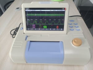 <span class=keywords><strong>Moniteur</strong></span> fœtal Rainbow PM-9000B+ Classe II, écran 7 pouces, analyse et diagnostic automatiques, batterie au lithium intégrée, alimentation électrique - Product Image 3