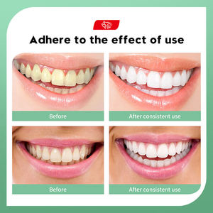 <span class=keywords><strong>Pasta</strong></span> <span class=keywords><strong>Dental</strong></span> Blanqueadora con Carbón de Bambú, Limpieza <span class=keywords><strong>Dental</strong></span>, Protección Gingival, Cuidado Bucal con Hierbas y Menta - Product Image 2