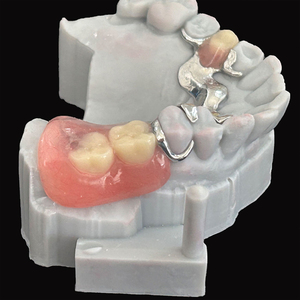 Marco de metal completo de mandíbulas <span class=keywords><strong>superior</strong></span> e inferior con <span class=keywords><strong>dentadura</strong></span> acrílica <span class=keywords><strong>parcial</strong></span> Precios súper bajos - Product Image 4