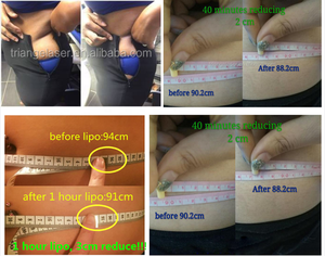 6d <span class=keywords><strong>lipo</strong></span> 레이저 슬리밍 머신 <span class=keywords><strong>lipo</strong></span> 레이저 950nm 810nm 650nm 뷰티 살롱 장치 - Product Image 6