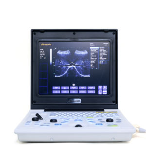 Mesin USG Portabel Warna PW Termurah Mesin USG Veteriner untuk Klinik B/W Laptop USG - Product Image 2