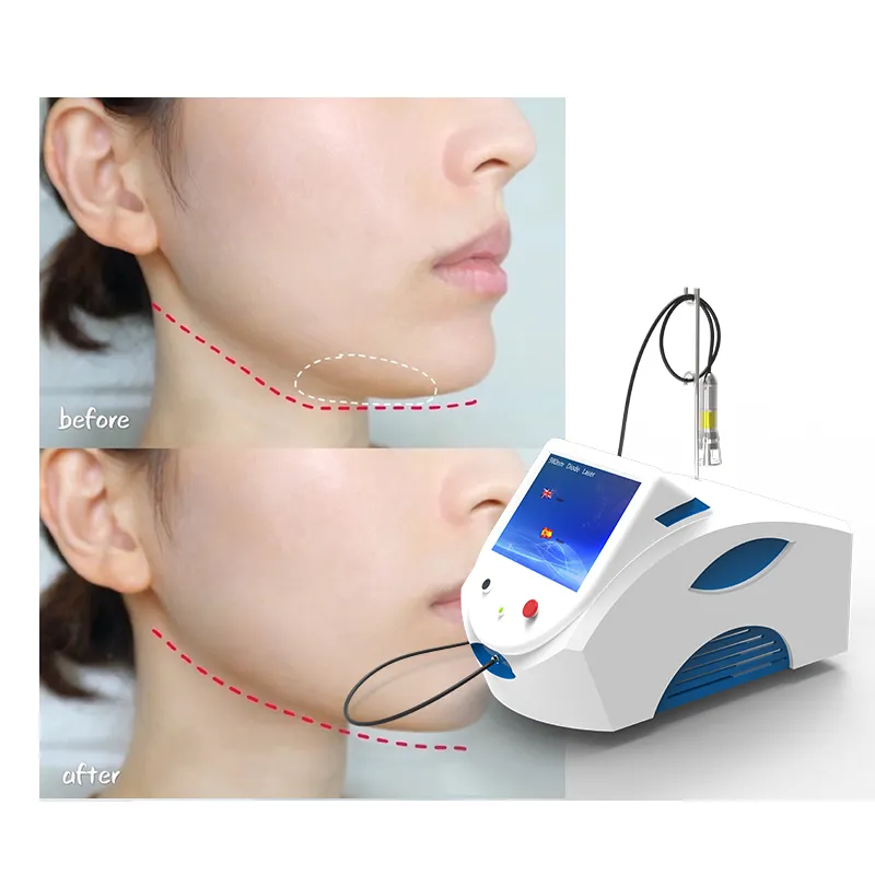 980nm face lifting laser 1470nm wavelength Vascular removal therapy Hemorrhoids PLDD surgery machine