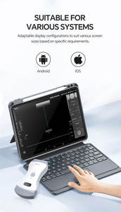 Appareil d'échographie portable CONTEC CMS1600B, échographe portable, équipement hospitalier - Product Image 4