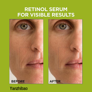 Suero Facial Antienvejecimiento con 1.5% de Ácido Hialurónico Puro OEM + 0.3% Puro para Reafirmar la Piel, Suero Nocturno - Product Image 2