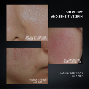 Commercio all'ingrosso Private Label prodotti cosmetici <span class=keywords><strong>per</strong></span> la cura della <span class=keywords><strong>pelle</strong></span> con macchie scure idratante <span class=keywords><strong>crema</strong></span> antirughe Anti-invecchiamento <span class=keywords><strong>per</strong></span> gli uomini - Product Image 6