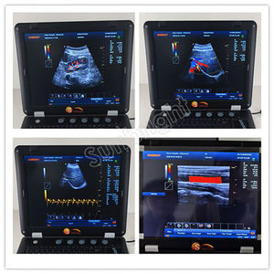 Equipo Médico Portátil de Ultrasonido Digital 4D, Duradero, para Uso Médico, con <span class=keywords><strong>Precio</strong></span> Competitivo - Product Image 3