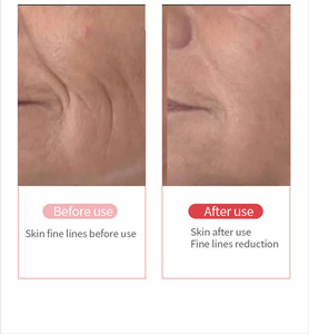 Estação Facial Profissional 6 em 1 SP-122: Limpeza, Lifting e Terapia Térmica para Serviços de Salão Aprimorados - Product Image 5