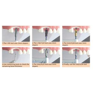 Kit menaikkan Sinus Internal <span class=keywords><strong>Dental</strong></span>, instrumen transplantasi tulang implan bedah turbin Set Osteotome - Product Image 5